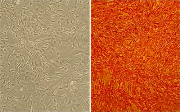 Bovine Pulmonary Artery Smooth Muscle Cells: BPASMC (Cryovial)