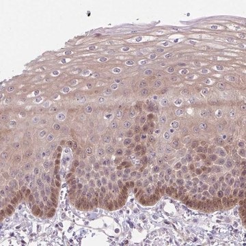 Anti-TAX1BP3 antibody produced in rabbit Prestige Antibodies&#174; Powered by Atlas Antibodies, affinity isolated antibody, buffered aqueous glycerol solution