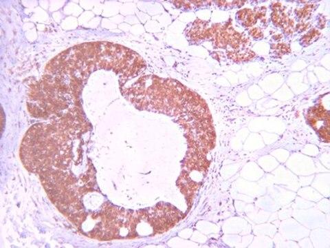 Anti-phospho-Akt (Thr308) Antibody from rabbit