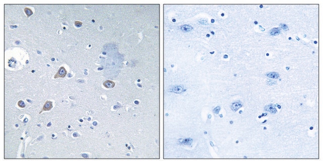 Anti-p70 S6 Kinase antibody produced in rabbit affinity isolated antibody