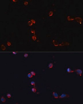 Anti-CAT antibody produced in rabbit