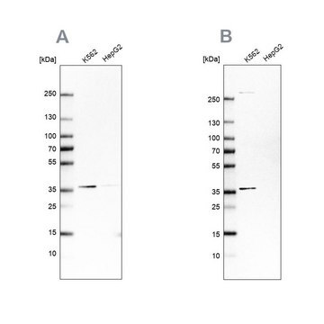 Anti-OTUD6B antibody produced in rabbit Prestige Antibodies&#174; Powered by Atlas Antibodies, affinity isolated antibody, buffered aqueous glycerol solution, Ab1