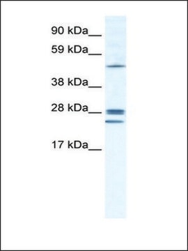 Anti-GJB2 antibody produced in rabbit IgG fraction of antiserum