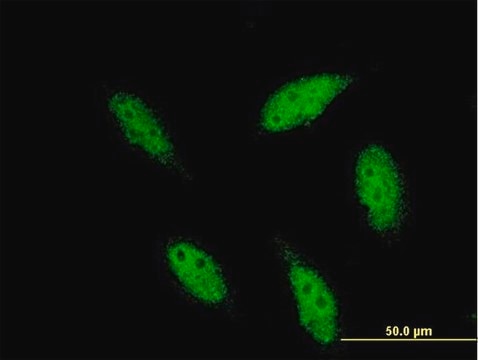 Monoclonal Anti-TBR1 antibody produced in mouse clone 3F6, purified immunoglobulin, buffered aqueous solution