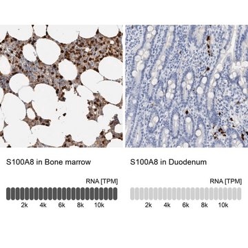 Anti-S100A8 antibody produced in rabbit Prestige Antibodies&#174; Powered by Atlas Antibodies, affinity isolated antibody, buffered aqueous glycerol solution