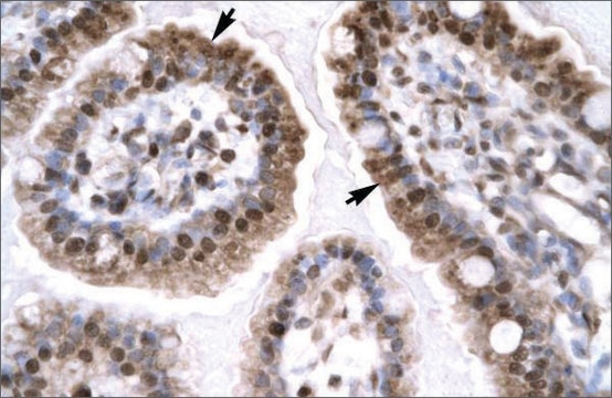 Anti-EGR1 antibody produced in rabbit affinity isolated antibody