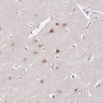 Anti-ACTR3 antibody produced in rabbit Prestige Antibodies&#174; Powered by Atlas Antibodies, affinity isolated antibody, buffered aqueous glycerol solution