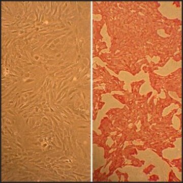 Rat Aortic Smooth Muscle Cells: RAOSMC, adult