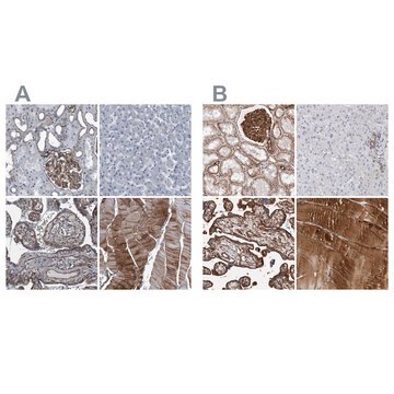 Anti-PLEC antibody produced in rabbit Prestige Antibodies&#174; Powered by Atlas Antibodies, affinity isolated antibody, buffered aqueous glycerol solution, ab2