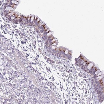 Anti-ABHD17A antibody produced in rabbit Prestige Antibodies&#174; Powered by Atlas Antibodies, affinity isolated antibody, buffered aqueous glycerol solution