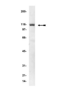 Anti-&#945;-Actinin Antibody, clone AT6/172 clone AT6/172, Upstate&#174;, from mouse