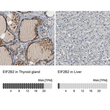 Anti-EIF2B2 antibody produced in rabbit Prestige Antibodies&#174; Powered by Atlas Antibodies, affinity isolated antibody, buffered aqueous glycerol solution