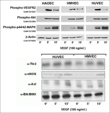 Human Umbilical Vein Endothelial Cells: HUVEC: Pre-Screened for Angiogenesis &amp; VEGF signaling, neonatal