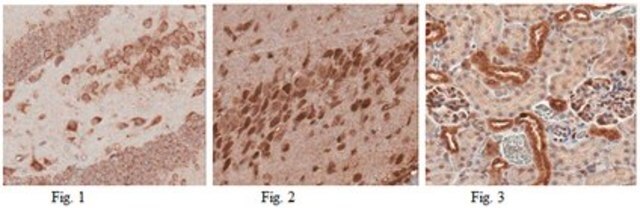 Anti-CYP27B1 Antibody from rabbit, purified by affinity chromatography