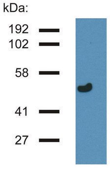 Monoclonal Anti-gammaTubulin antibody produced in mouse clone TU-32