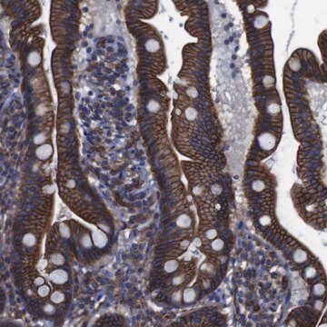 Anti-SPTBN1 antibody produced in rabbit Prestige Antibodies&#174; Powered by Atlas Antibodies, affinity isolated antibody, buffered aqueous glycerol solution