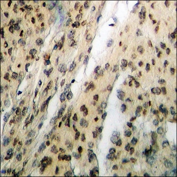 Anti-phospho-Chk1 (pSer317) antibody produced in rabbit affinity isolated antibody