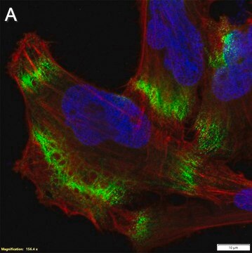 Anti-MCT1/SLC16A1 Antibody, clone 2B21 ZooMAb&#174; Rabbit Monoclonal recombinant, expressed in HEK 293 cells