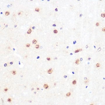 Anti-KLF4 antibody produced in rabbit