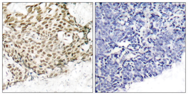 Anti-p95 antibody produced in rabbit affinity isolated antibody