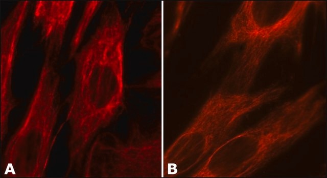 Anti-Vimentin antibody, Mouse monoclonal clone VIM-13.2, purified from hybridoma cell culture