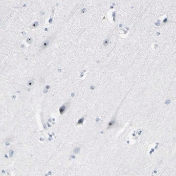 Anti-ZSCAN1 antibody produced in rabbit Prestige Antibodies&#174; Powered by Atlas Antibodies, affinity isolated antibody, buffered aqueous glycerol solution