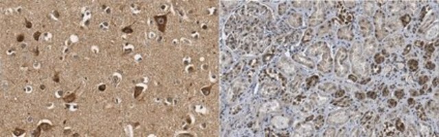 Anti-RNF213 from rabbit, purified by affinity chromatography