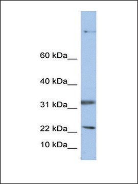 Anti-SEP15 antibody produced in rabbit affinity isolated antibody