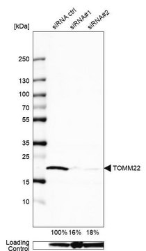 Anti-TOMM22 antibody produced in rabbit affinity isolated antibody, buffered aqueous glycerol solution