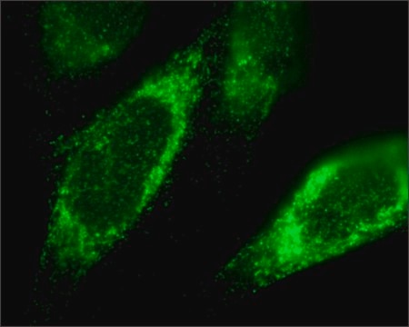 Anti-TFRC antibody produced in rabbit ~1.0&#160;mg/mL, affinity isolated antibody