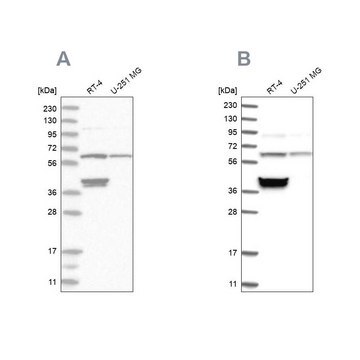 Anti-TCP1 antibody produced in rabbit Prestige Antibodies&#174; Powered by Atlas Antibodies, affinity isolated antibody, buffered aqueous glycerol solution, ab1