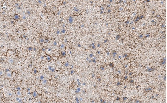 Anti-GAD67 Antibody, clone 1G10.2 ZooMAb&#174; Mouse Monoclonal recombinant, expressed in HEK 293 cells