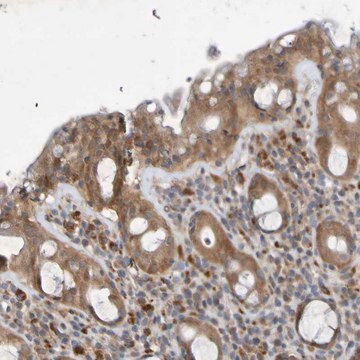 Anti-SDK1 antibody produced in rabbit Prestige Antibodies&#174; Powered by Atlas Antibodies, affinity isolated antibody, buffered aqueous glycerol solution