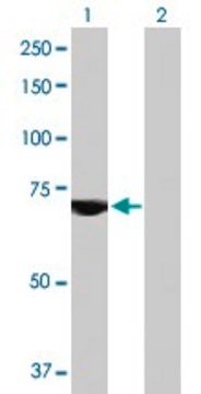 Anti-USP2 antibody produced in mouse purified immunoglobulin, buffered aqueous solution