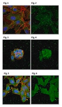 Anti-Tankyrase-1/TNKS Antibody, clone 7D1.2 clone 7D1.2, from mouse