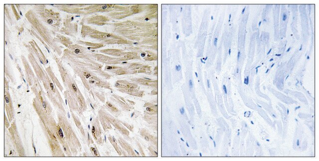 Anti-RPL22 antibody produced in rabbit affinity isolated antibody