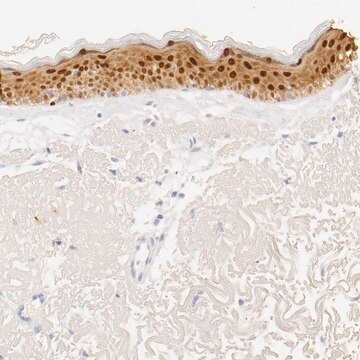 Anti-LGALS7 antibody produced in rabbit Prestige Antibodies&#174; Powered by Atlas Antibodies, affinity isolated antibody, buffered aqueous glycerol solution