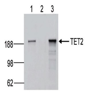 Anti-TET2 Antibody, clone hT2H 21F11 clone hT2H21F11, from mouse