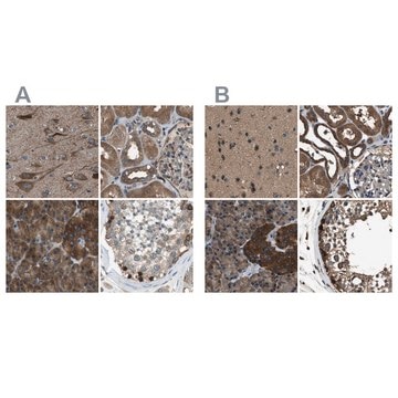 Anti-ARFGAP2 antibody produced in rabbit Prestige Antibodies&#174; Powered by Atlas Antibodies, affinity isolated antibody, buffered aqueous glycerol solution