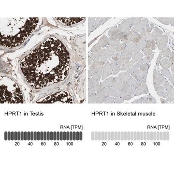 Anti-HPRT1 antibody produced in rabbit Prestige Antibodies&#174; Powered by Atlas Antibodies, affinity isolated antibody, buffered aqueous glycerol solution