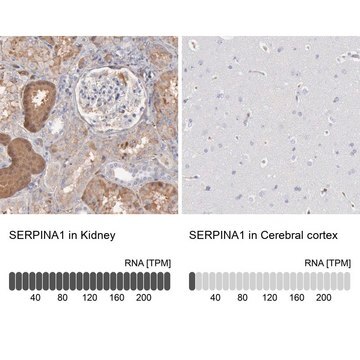 Anti-SERPINA1 antibody produced in rabbit Prestige Antibodies&#174; Powered by Atlas Antibodies, affinity isolated antibody, buffered aqueous glycerol solution