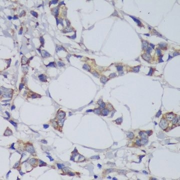 Anti-GSK3B antibody produced in rabbit