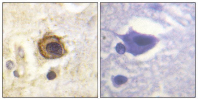 Anti-PDGFR &#946; antibody produced in rabbit affinity isolated antibody