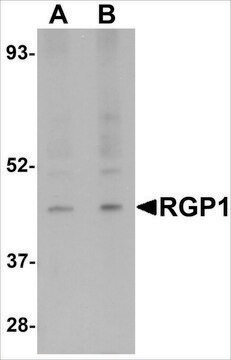 Anti-RGP1 antibody produced in rabbit affinity isolated antibody, buffered aqueous solution