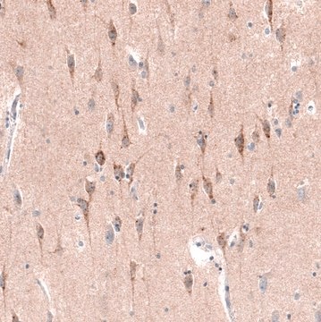 Monoclonal Anti-CTGF antibody produced in mouse Prestige Antibodies&#174; Powered by Atlas Antibodies, clone CL5339, purified immunoglobulin, buffered aqueous glycerol solution