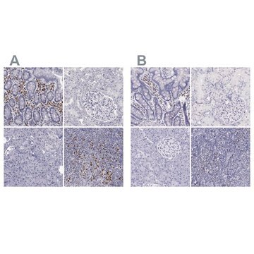 Anti-IRF4 antibody produced in rabbit Ab1, Prestige Antibodies&#174; Powered by Atlas Antibodies, affinity isolated antibody, buffered aqueous glycerol solution