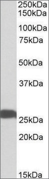 Anti-UCHL1 antibody produced in goat affinity isolated antibody, buffered aqueous solution