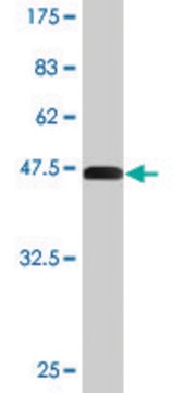 Monoclonal Anti-CTGF antibody produced in mouse clone 2C11, purified immunoglobulin, buffered aqueous solution