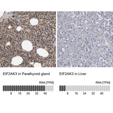 Anti-EIF2AK3 antibody produced in rabbit Prestige Antibodies&#174; Powered by Atlas Antibodies, affinity isolated antibody, buffered aqueous glycerol solution