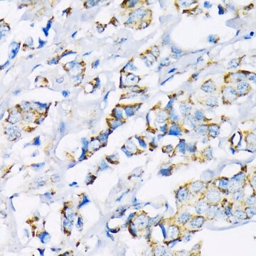 Anti-Hexokinase II antibody produced in rabbit